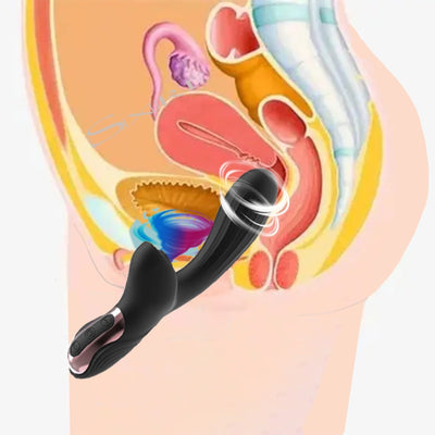 Sex Clit Sucker Silicone Vagina Sucking Vibrators Vibrating Vibrat Sucker Clitori Stimulator Sex Clit Toy Mlp Woman Masturbation